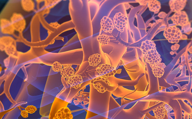 Altering the trajectory of COPD exacerbations