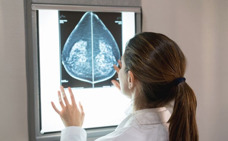 Anastrozole indication expanded by MHRA to include breast cancer prevention