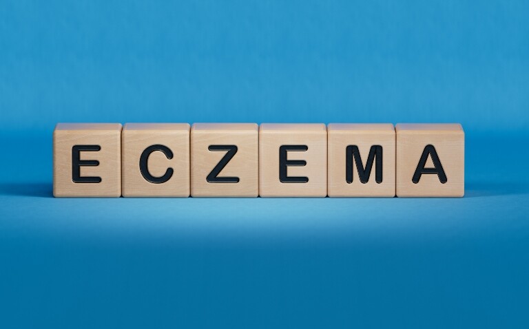 Wooden blocks with black lettering spelling out eczema on a blue background to illustrate the finding that atopic eczema is linked to a significantly higher risk of suicidal thoughts