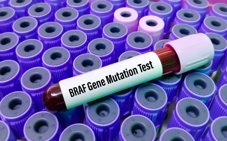 A test tube sample of blood laying on top of a tray of test tubes with purple lids with the label BRAF gene mutation test to illustrate testing shortfalls and survival impact in melanoma
