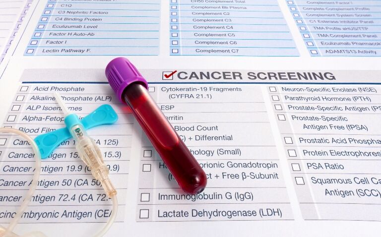 Biomarker and MRI-enhanced strategies comparable for prostate cancer screening