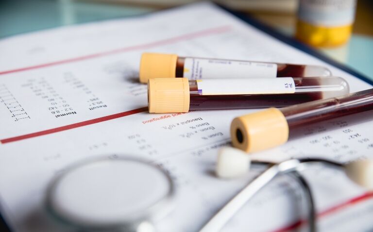 Blood protein test could ‘kickstart’ new generation of early cancer detection
