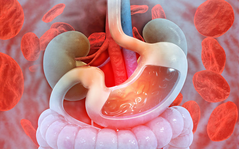 Both GBS and CANUKA identify low risk ED patients following upper GI bleed