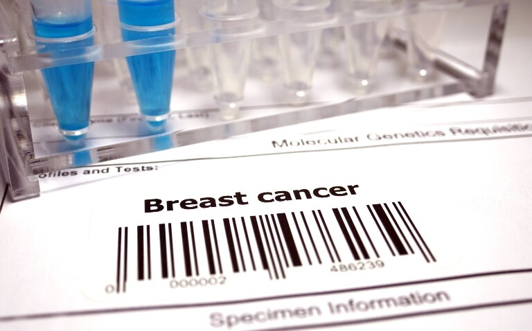 A close up of a specemin information form for molecular genetics with a bar code and the words breast cancer above it to illustrate the discovery that breast cancer polygenic risk scores predict invasive disease development