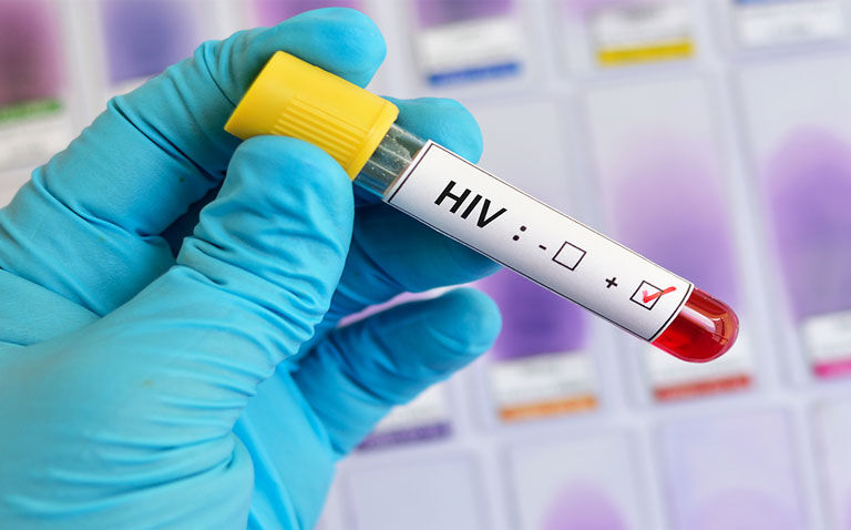 Cabotegravir gains positive CHMP opinion for HIV prevention