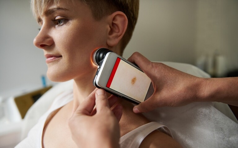 Close-up of a healthcare professional examining a mole on the neck of a young woman using a smartphone device to illustrate teledermatology becoming standard practice in the NHS and dermatologists calling for an AI roadmap to support implementation