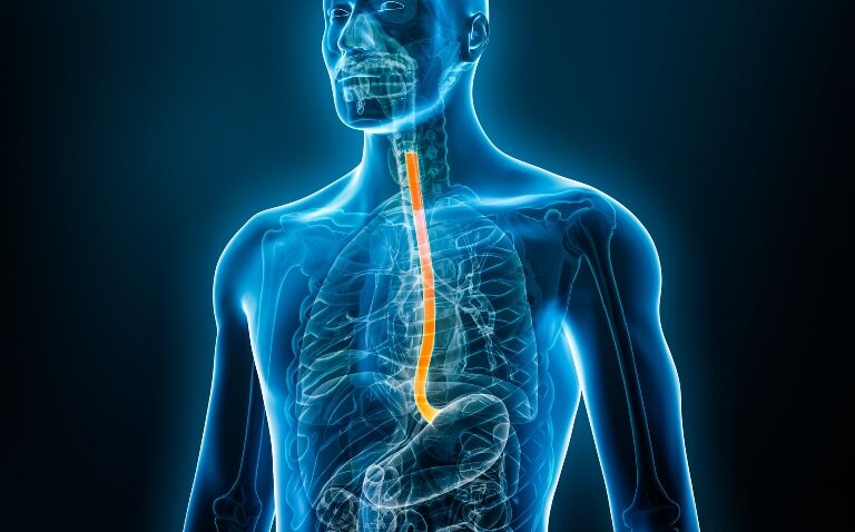 Capsule sponge test shown to increase efficiency and replace need for endoscopy in thousands of patients
