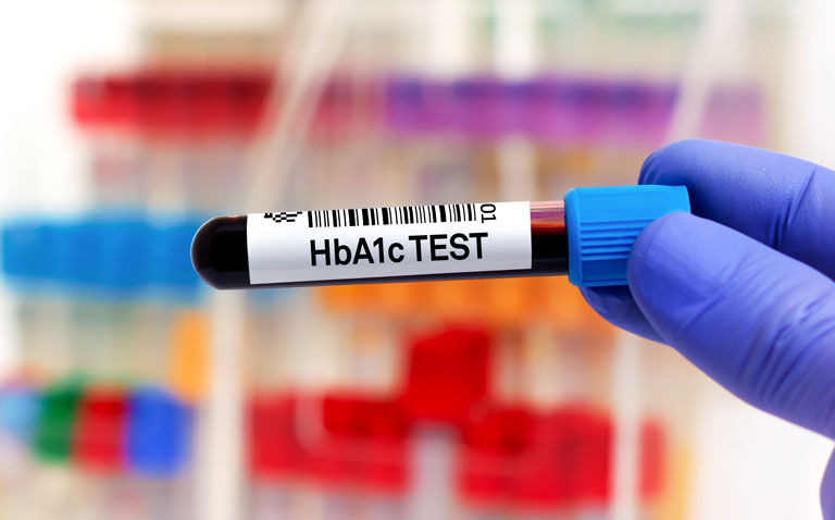 Cumulative HbA1c levels above 9% linked to greater dementia risk