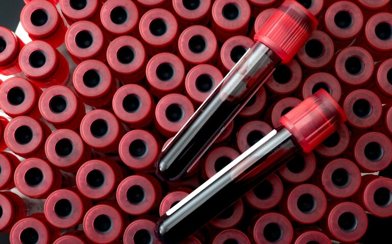 A birds eye view of a rack of test tubes with two test tubes containing blood samples on top to illustrate a debate over blood tests for cancer screening