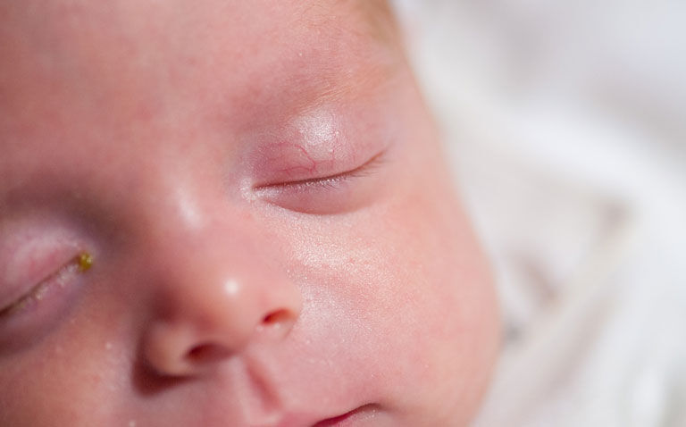 Delivering neonatal parenteral nutrition: the importance of the MDT