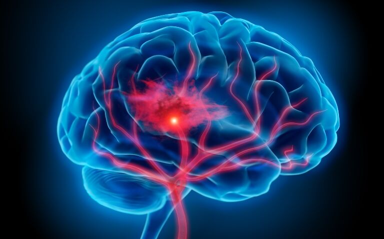 Device mimicking robotic controller outperforms joystick for neuroradiology procedures
