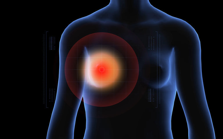 Driving efficiencies in breast cancer screening via AI with Dr Gerald Lip