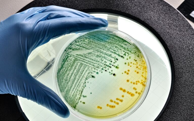 EDs must notify cases of bloody diarrhoea amid UK E. coli ‘food item’ warning