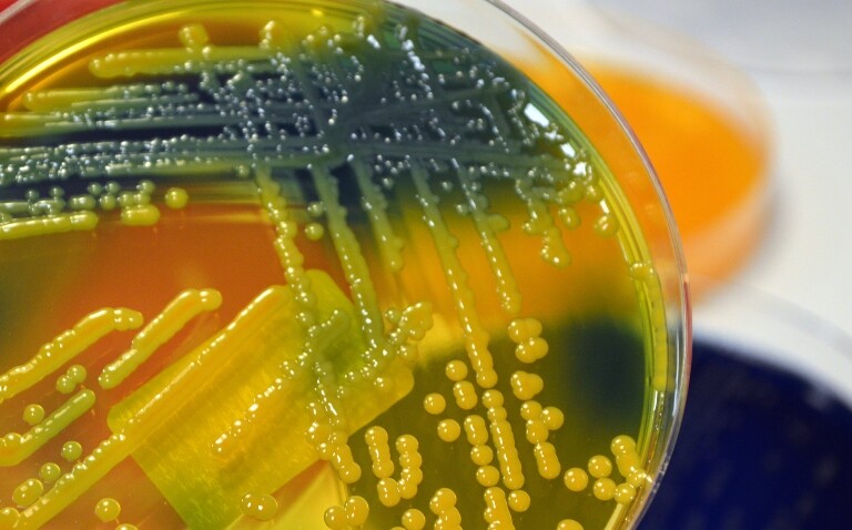 Close-up of Klebsiella pneumoniae bacterial colonies growing on a yellow-green agar plate with blue and yellow petri dishes in the background to illustrate ESCMID Global 2025 and action on infectious diseases