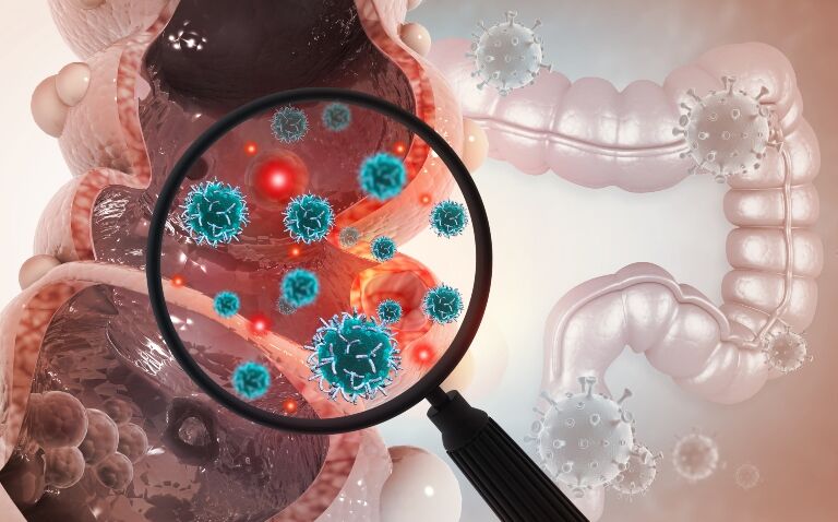 EU and US approval for trifluridine/tipiracil use in metastatic colorectal cancer