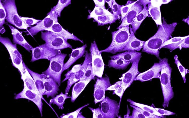 EU approval granted for nivolumab as adjuvant treatment for resected stage IIB or IIC melanoma