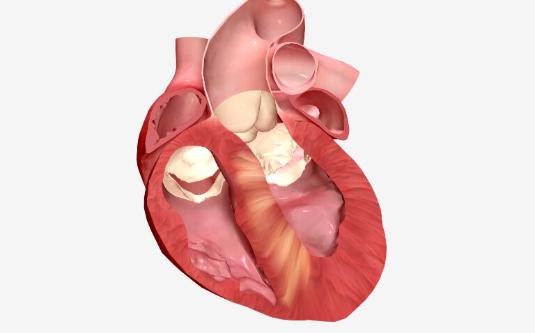Early detection of hypertrophic cardiomyopathy enabled through cutting-edge scanning