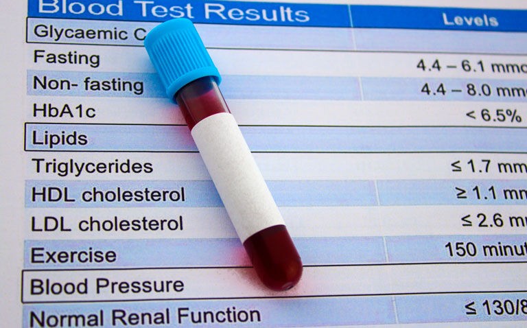 Elevated LDL triglycerides linked to higher risk of atherosclerotic cardiovascular disease