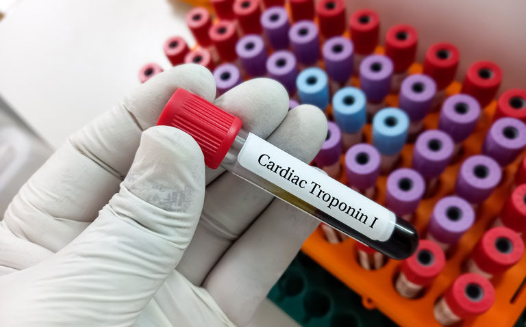 Elevated cardiac troponin in acute dyspnoea a possible marker for a poor prognosis