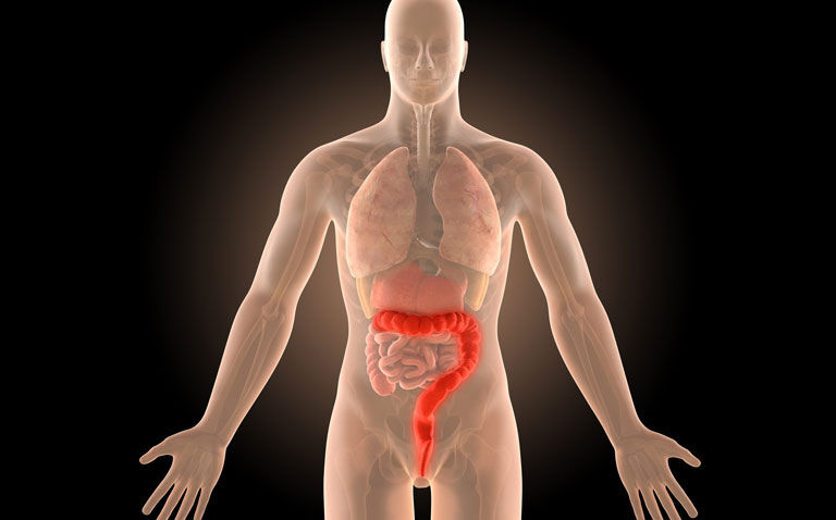 Endocan a potentially useful biomarker for disease extent in ulcerative colitis