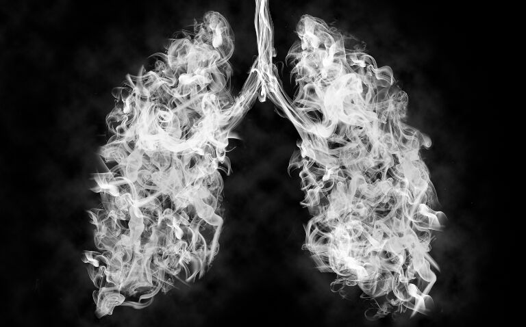 England's first-ever lung cancer screening programme to see national rollout