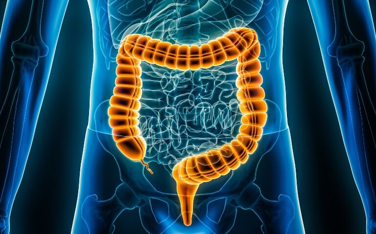 Etrasimod positive opinion for ulcerative colitis upgraded to approval in EU