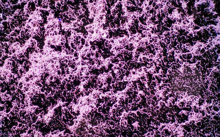 A microscopic view of the Bacillus bacteria and a member of the phylum Firmicutes to illustrate gut biomarkers being identified to improve the detection and targeted treatment of GI disorders