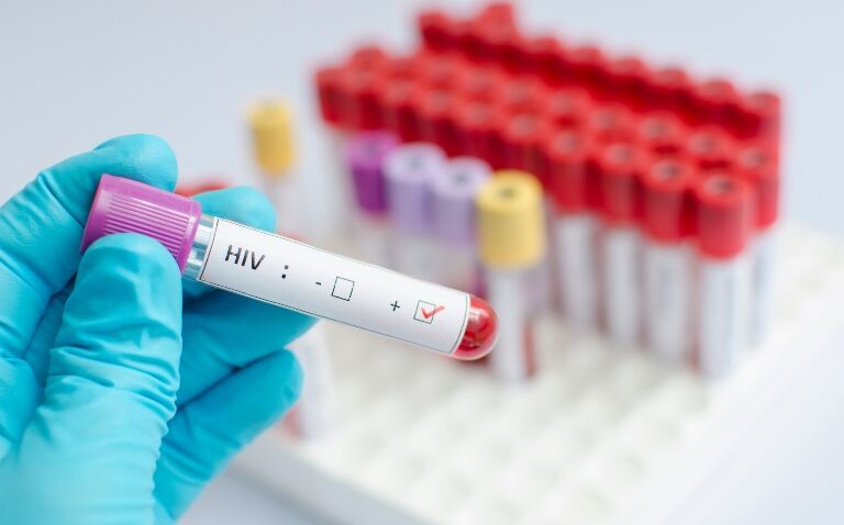 HIV given ‘testing turbo boost’ with expanded opt-out programme in emergency departments