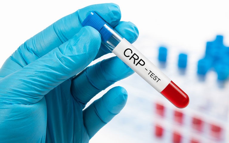 High-sensitivity CRP superior to LDL cholesterol for CV event and mortality risk prediction