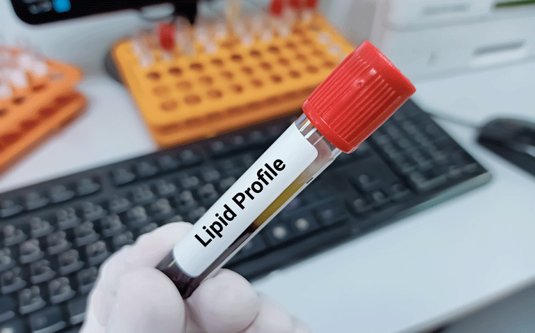 Higher lipoprotein A in hypertensives increases risk of adverse cardiovascular events
