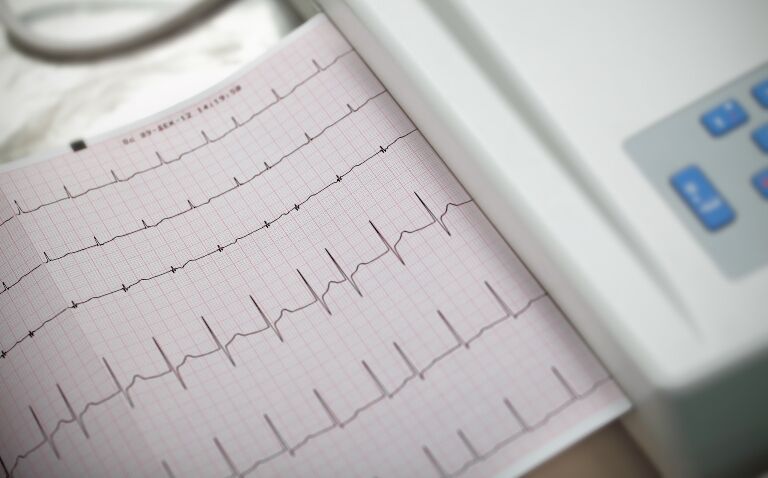 International consensus statement on catheter or surgical ablation for atrial fibrillation published
