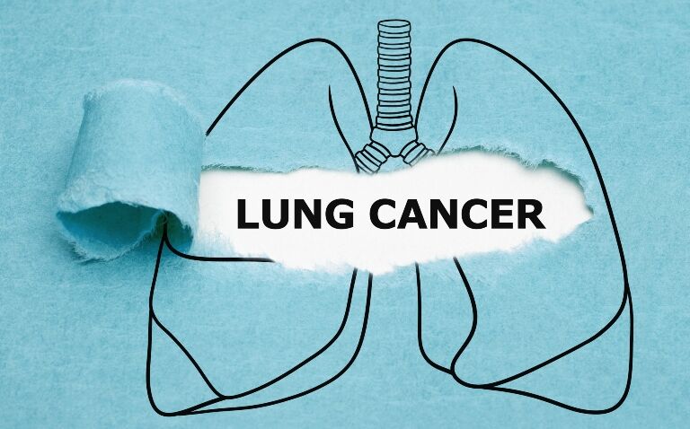 Is two years enough for immune checkpoint inhibitor therapy in non-small cell lung cancer?