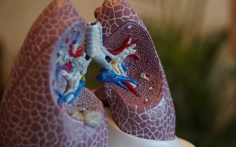 Lung disorders are complication of type 2 diabetes