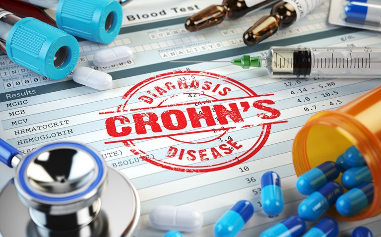 MHRA approves rinvoq for moderate to severe Crohn's disease