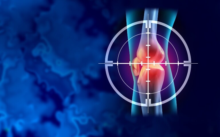 A digital illustration of a of a knee joint highlighted in red with a target overlay to illustrate a groundbreaking new study mapping unique synovial tissue processes in JIA