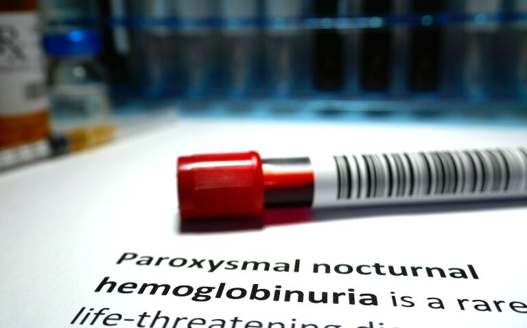 A test tube of blood with a barcode on it resting on a section of a dictionary definition of paroxysmal nocturnal haemoglobinuria with medical containers in the background
