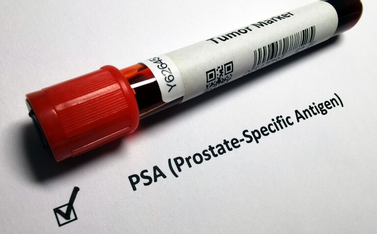 A test tube of blood with a tick box underneath for PSA or prostate-specific antigen to illustrate new evidence for PSA screening in prostate cancer