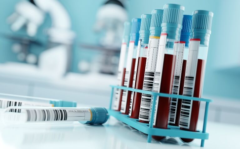 New approach to Alzheimer's diagnosis unveiled as consultation opens for feedback