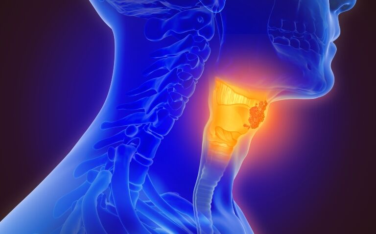 New device and app to detect throat cancer via live endoscopy examinations to be piloted