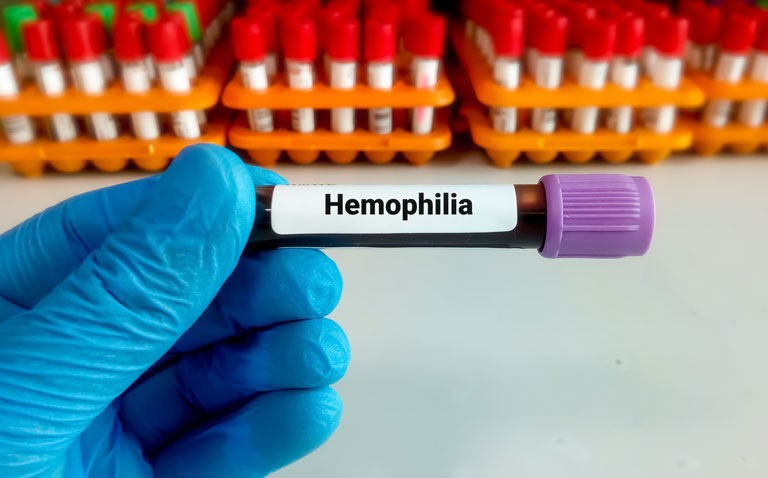 Novel agent effective for haemophilia A