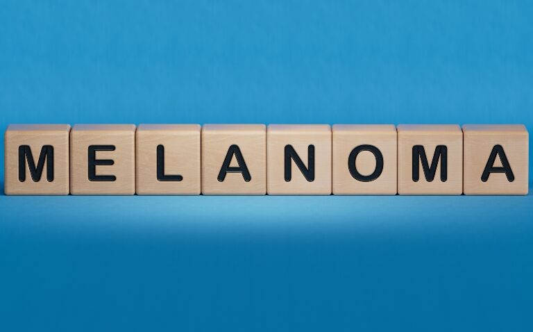 Wooden blocks spelling out melanoma on a blue background to illustrate the iFRET tool predicting immunotherapy outcomes