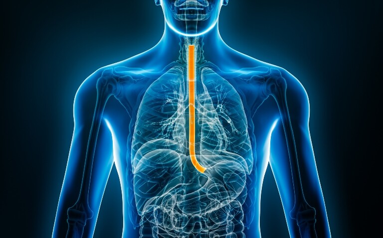 A digital illustration of a transparent human body with male contours and the outline of internal organs visible and the oesophagus highlighted in orange to illustrate optimised surveillance in Barrett's oesophagus using a capsule-sponge test