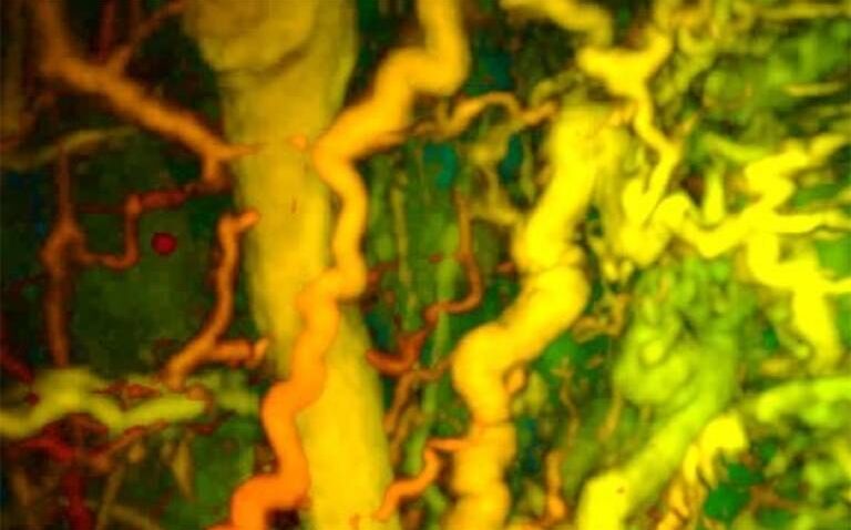 Photoacoustic imaging milestone paves the way for early diagnosis of multiple conditions