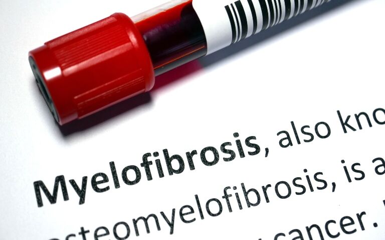 Positive CHMP opinion for momelotinib use in myelofibrosis patients with anaemia