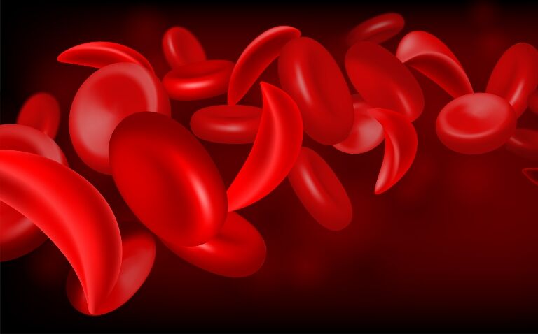 Potential curative treatment found for sickle cell disease through stem cell gene therapy