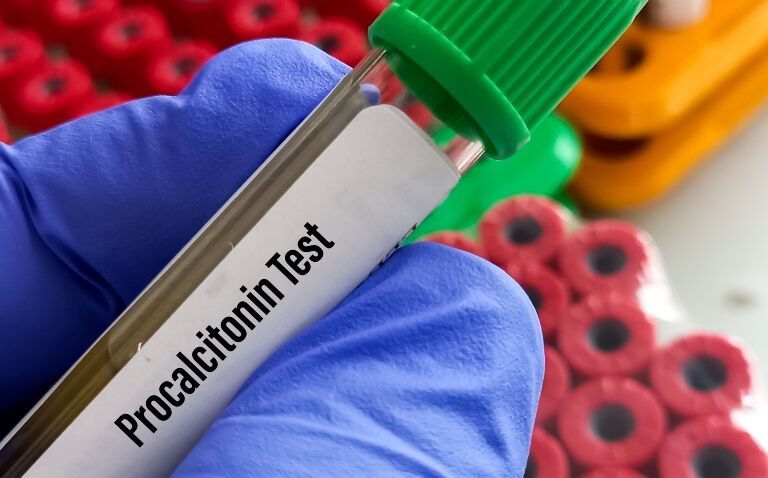 Procalcitonin monitoring could significantly reduce antibiotic overuse in sepsis