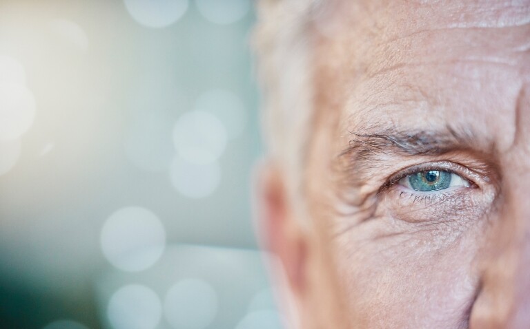A close-up of an older man's eye and right side of his face to illustrate the finding that psoriasis is linked to increased risk of age-related macular degeneration