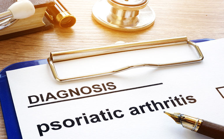 Psoriatic arthritis risk estimation tool reasonably accurate in psoriasis patients