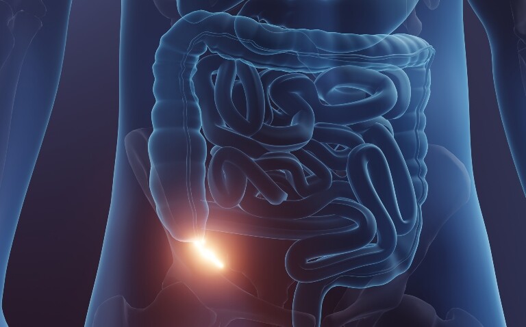 A computer generated medical illustration showing the human digestive system with the appendix highlighted in the lower right abdomen to illustrate the AlliGatOr study reshaping appendectomy care and emergency surgical systems