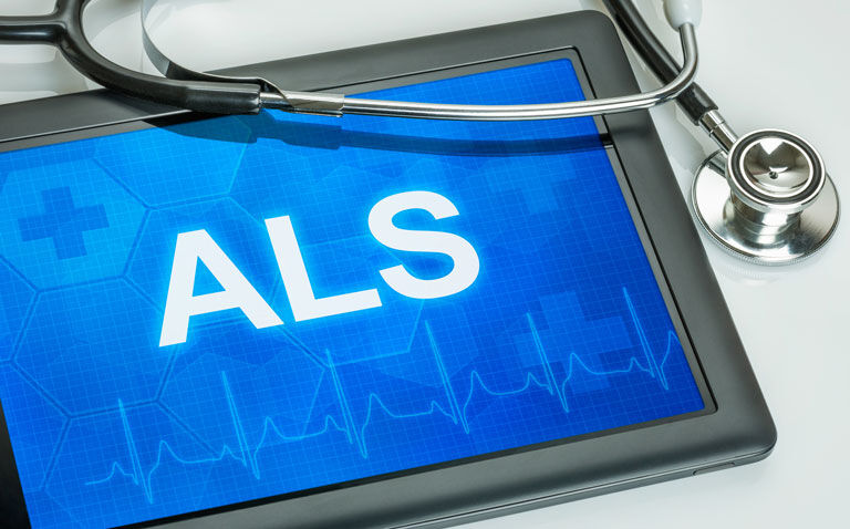 Ropinirole delays time to disease progression in amyotrophic lateral sclerosis